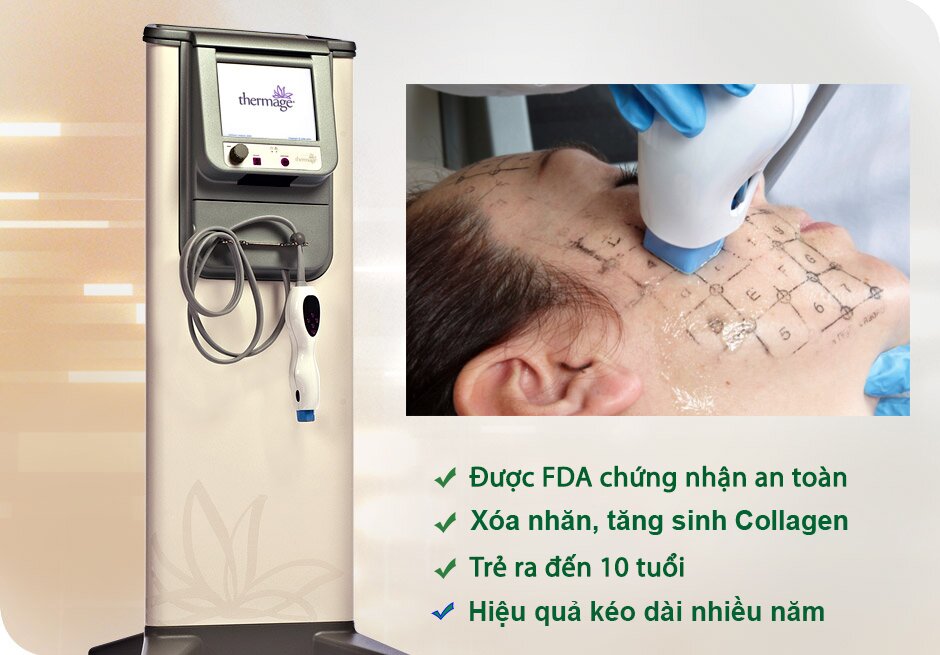 Xóa Nhăn Bằng Vô Tuyến Điện Dung CRF xoa-nhan-vo-tuyen-dien-dung-crf
