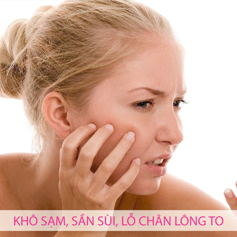 Làm cách nào thoát khỏi làn da khô sạm, sần sùi, lỗ chân lông to chỉ 60 phút?