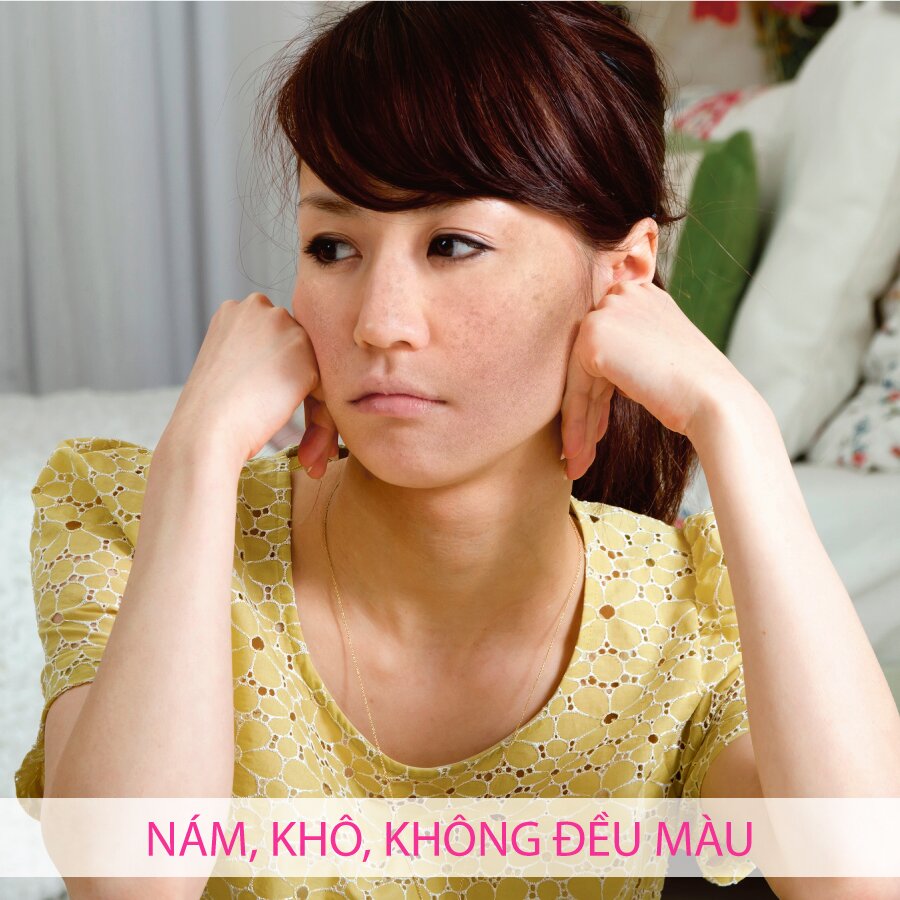 Trị nám bằng tế bào gốc thực vật chỉ 500k/phiếu điều trị lần đầu