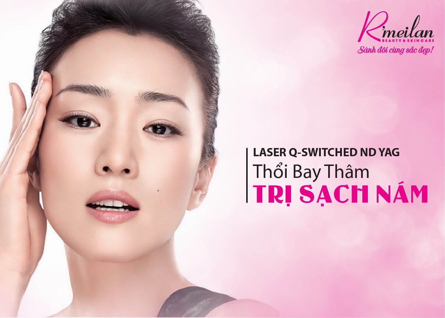 LASER Q-SWITCHED ND YAG – ĐỈNH CAO CỦA CÔNG NGHỆ TRỊ THÂM NÁM