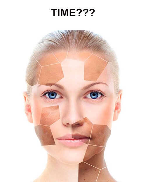Điều trị nám bằng Laser bao lâu thì hết?