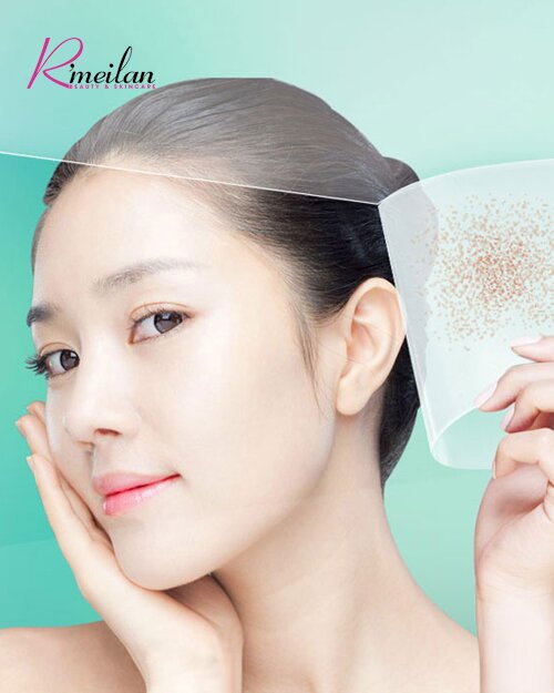 Điều trị nám da mặt hiệu quả với những nguyên liệu chưa tới 5k