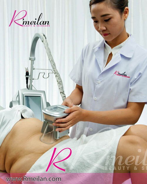 Giảm béo Quang Đông Mỡ tại Thẩm mỹ viện R