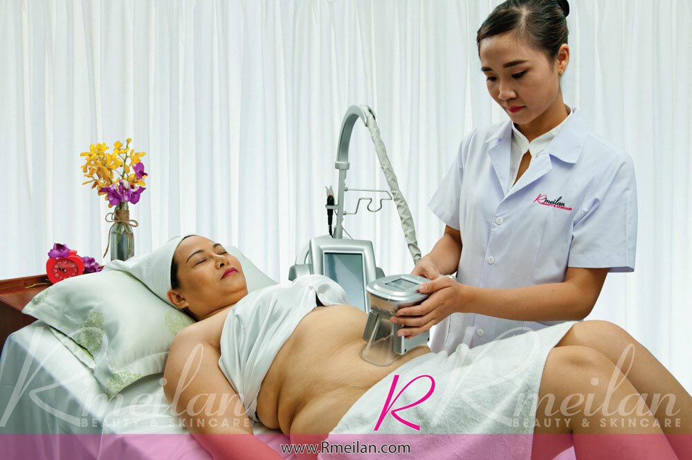 Đăng ký mua phiếu giảm mỡ 300k