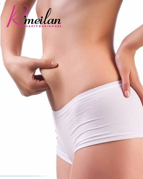  Ultra Cavitation - Khắc tinh của mỡ thừa cứng đầu, mỡ chai lì lâu năm