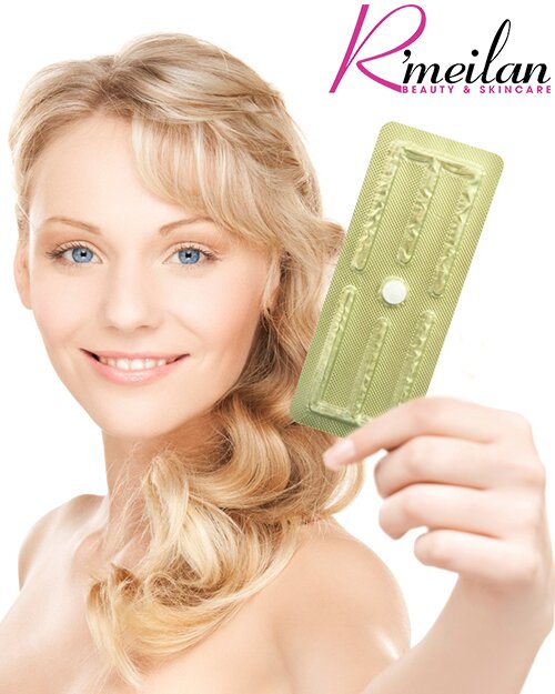 Nên hay không điều trị mụn bằng Diane 35?