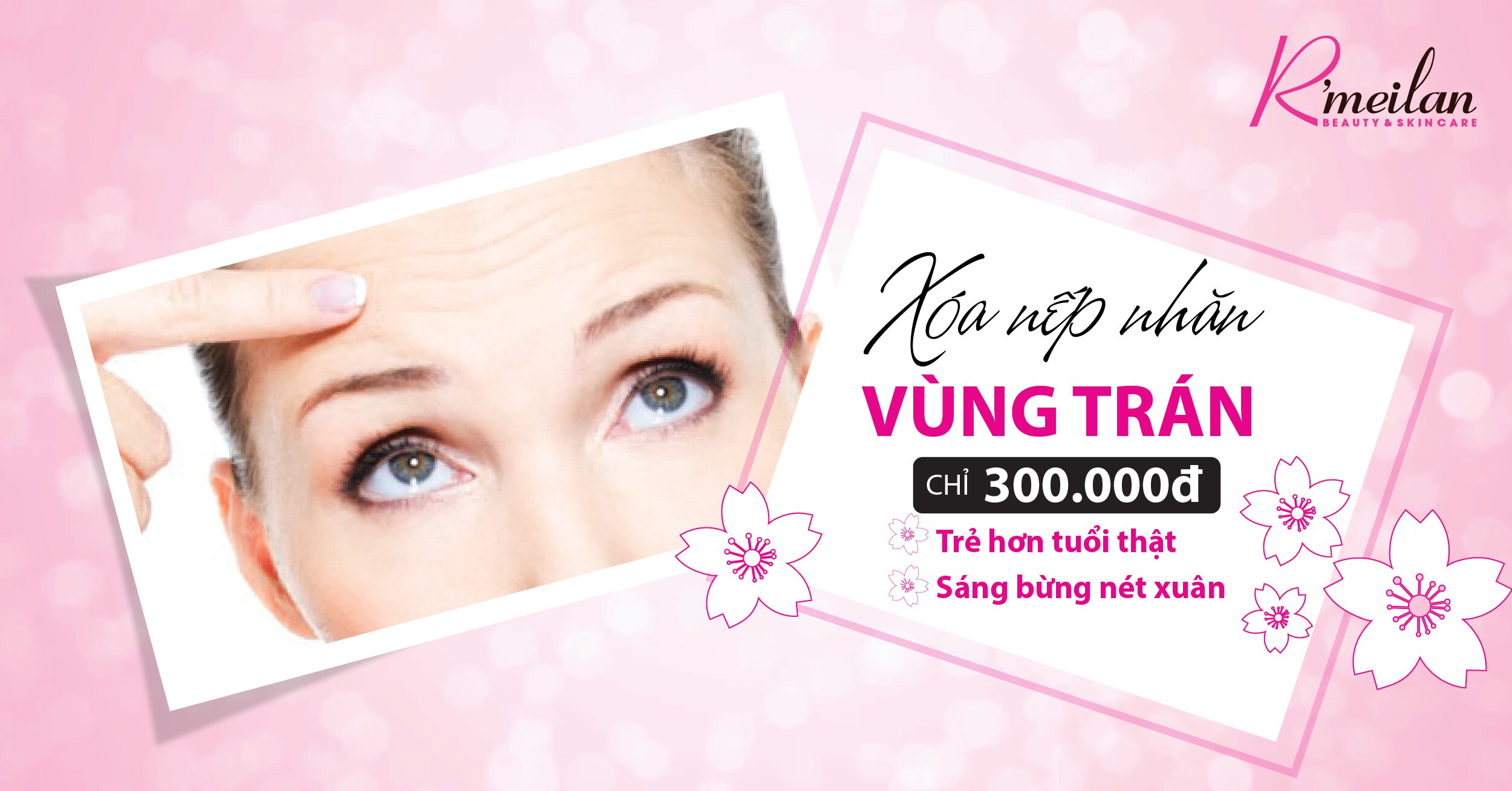 ĐĂNG KÍ DỊCH VỤ XÓA NHĂN TRÁN 300K
