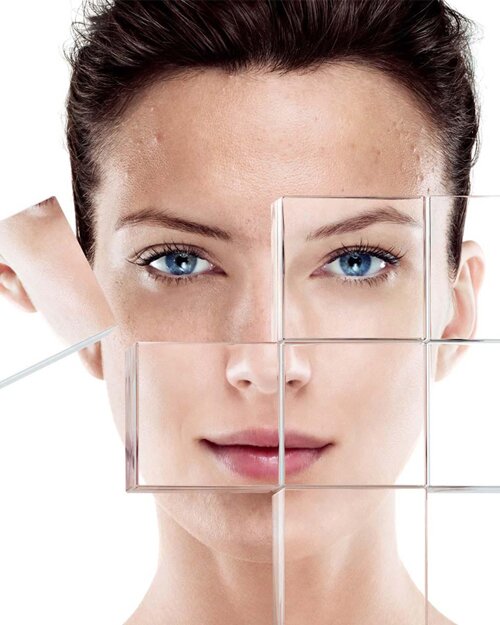 Những điều cần chú ý khi điều trị nám bằng Laser