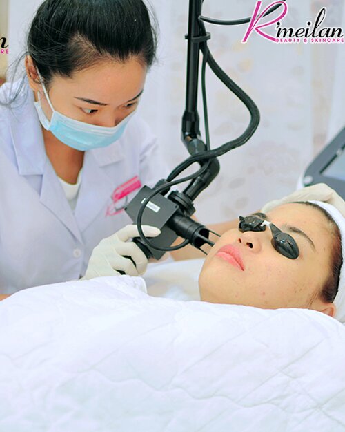  Tư vấn điều trị sẹo rỗ hiệu quả - Mới nhất 2016