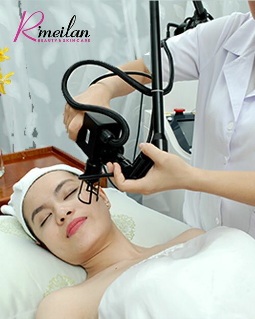Điều trị nám bằng Laser – Cách diệt nám không tái phát