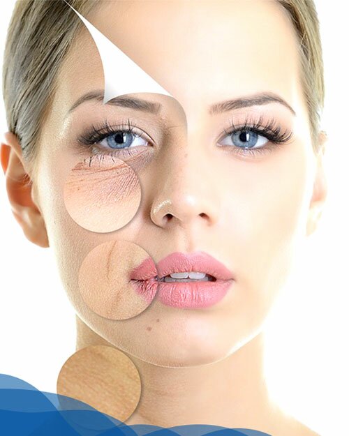 Bí mật ít ai biết về giải pháp xóa nhăn, nâng cơ, trẻ hóa da mặt Hifu